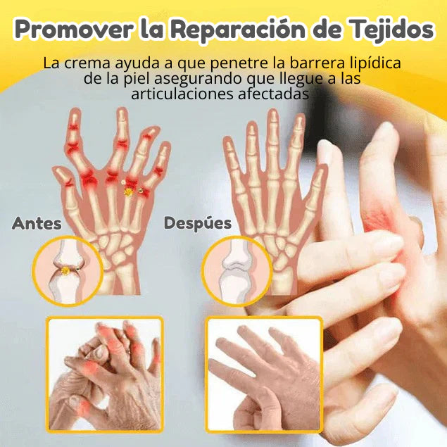 ✨ Alivio Total del Dolor y Rejuvenecimiento de la Piel en el mismo Día - Crema con Veneno de Abeja